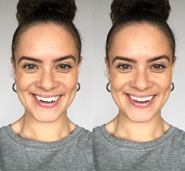 Before After
