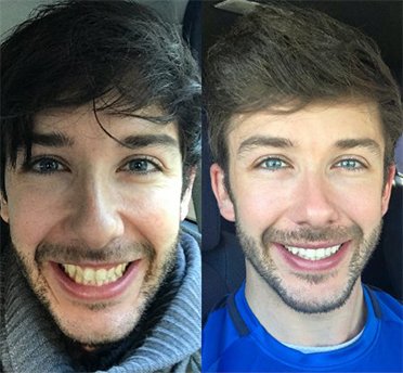Before After