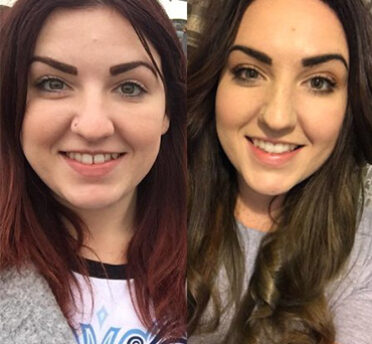 Before After